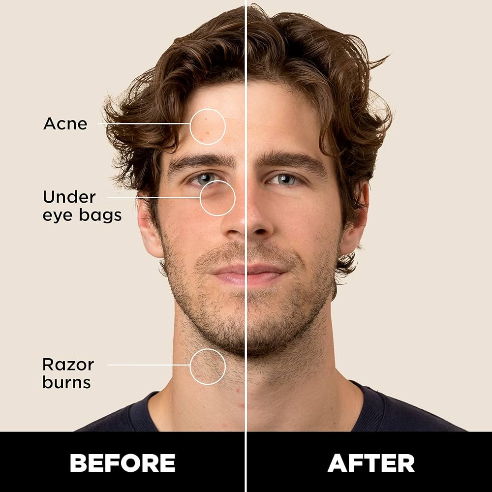 ToniQ Men's Concealer Pen